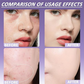 Corrector Mate para Rostro y Cuerpo